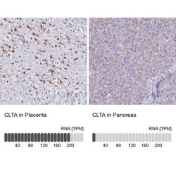 Clathrin light chain Antibody, Novus Biologicals:Antibodies:Primary Antibodies
